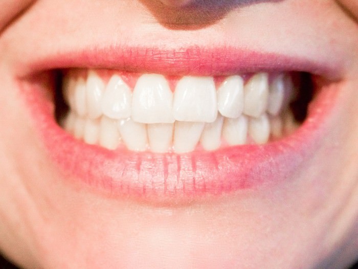 歯周病対策歯磨き粉おすすめ人気ランキングTOP3・口コミ