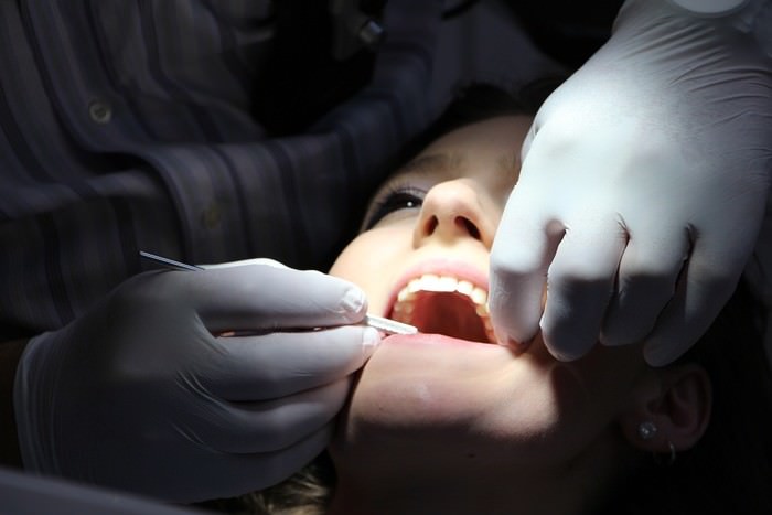 歯列矯正の費用の分割方法・相場の金額｜下の歯/前歯のみ